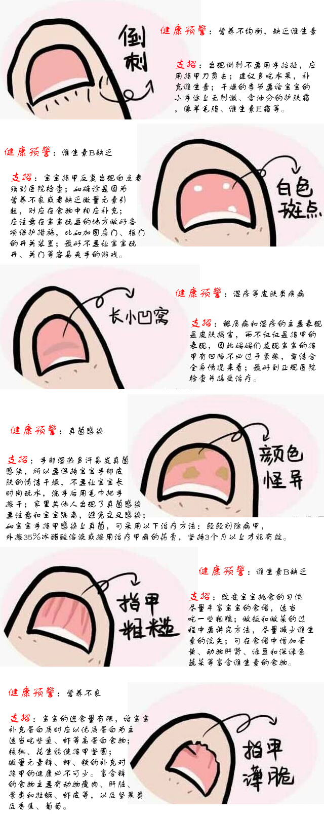 图说小秘密 宝宝指甲发出的健康信号